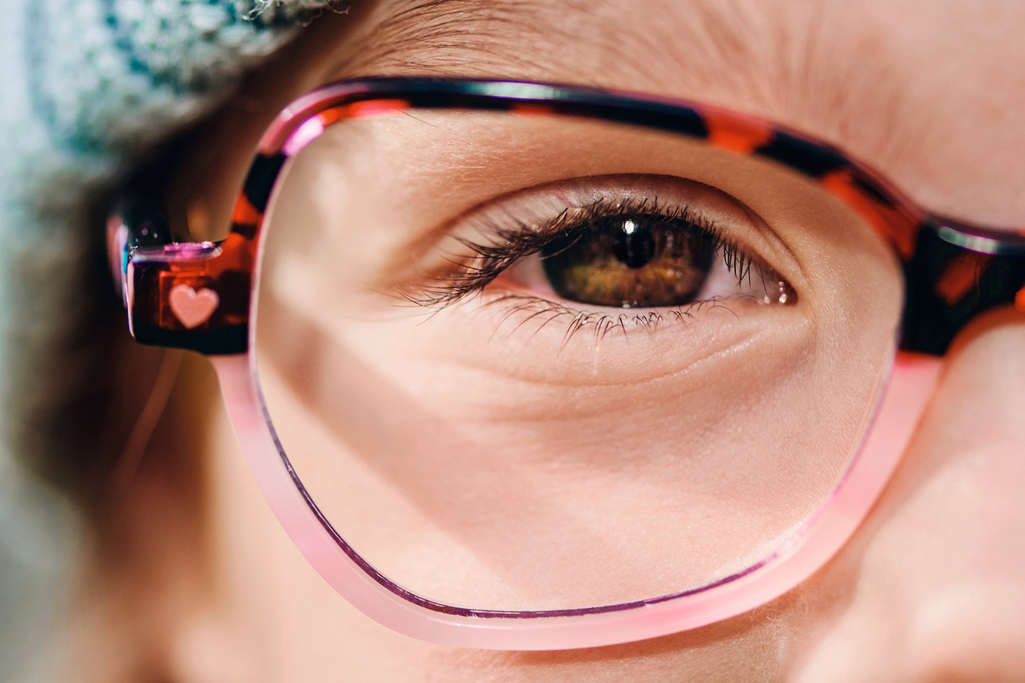 Myopie-Management bei Kindern Nahaufnahme eines Auges hinter einer rosa Brille mit Herzmotiv am Bügel.